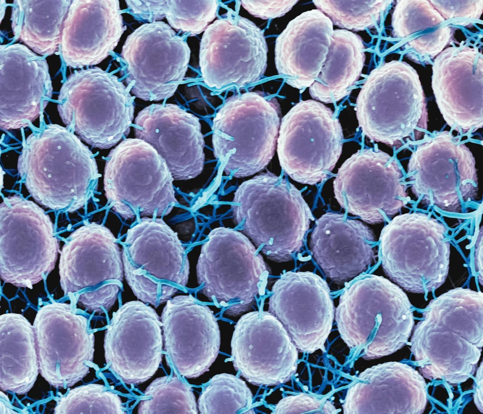 Temsili: Gonore izlemesinde antibiyotik direnci artışı görüldü